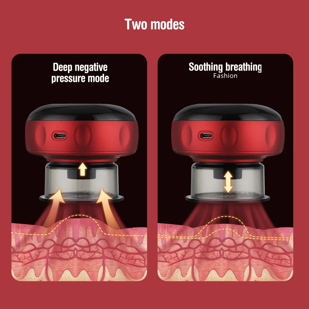 SWIFT Pro Cupping Technology